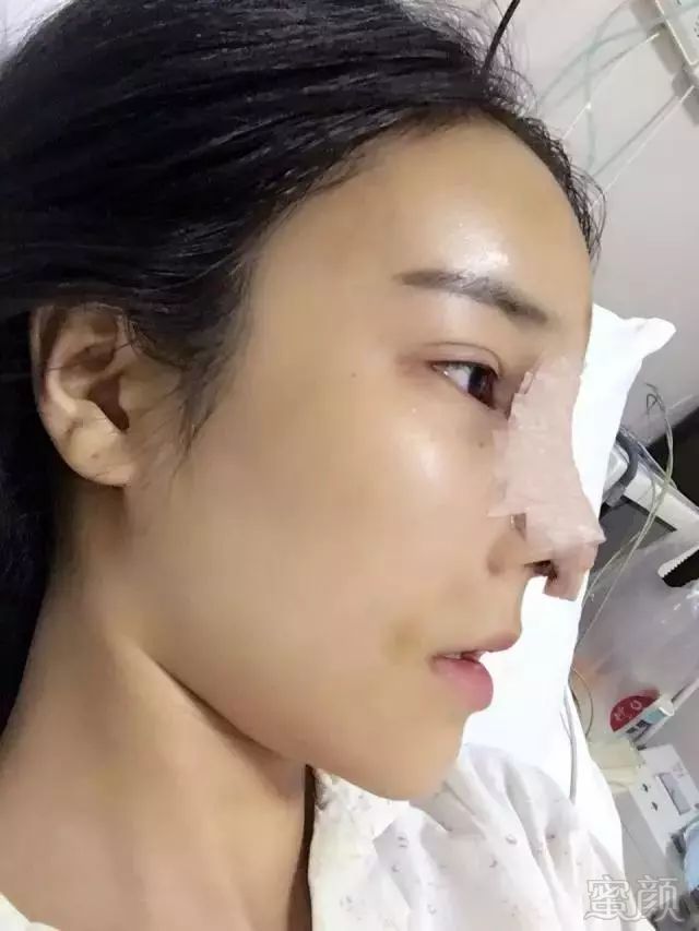 https://img.miyanlife.com/mnt/timg/180805/1320402J2-7.jpg