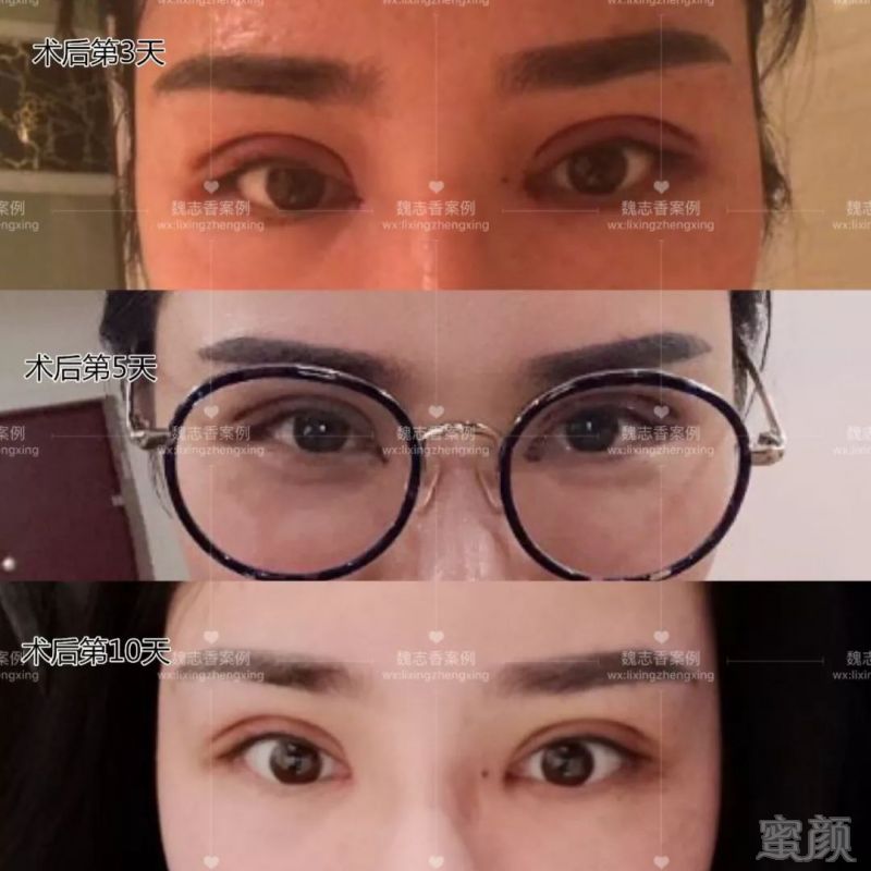 https://img.miyanlife.com/mnt/timg/180805/13302RB1-2.jpg