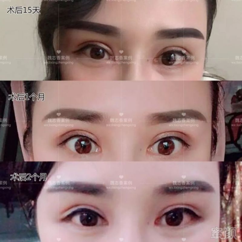 https://img.miyanlife.com/mnt/timg/180805/13302U618-3.jpg