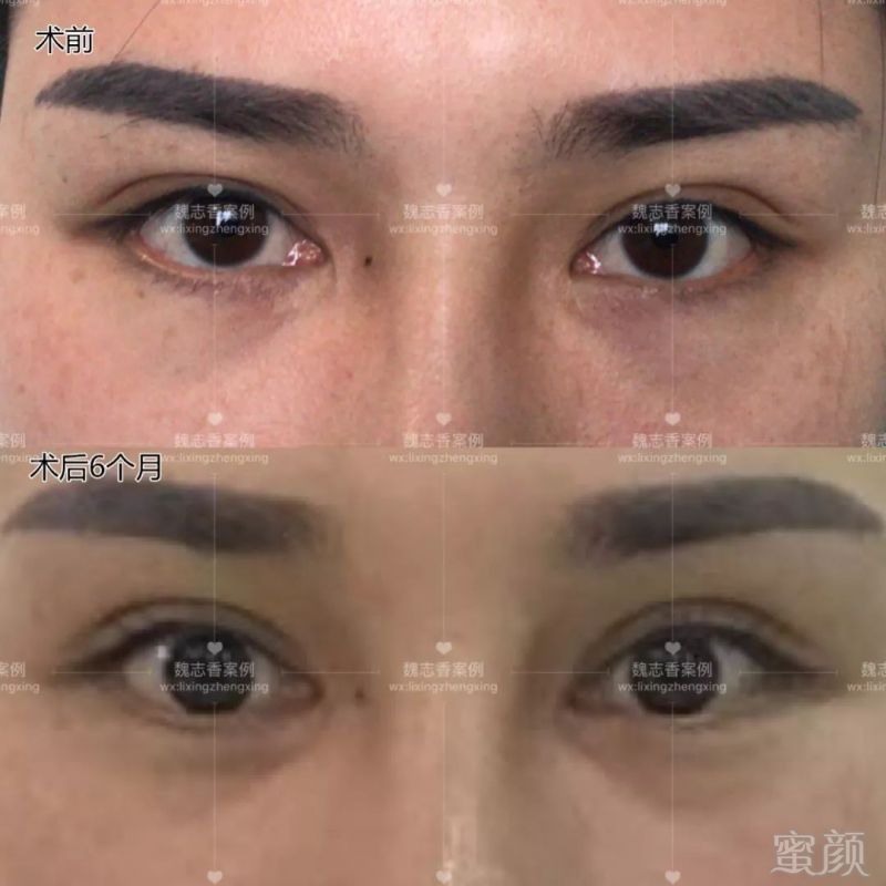https://img.miyanlife.com/mnt/timg/180805/13302aM0-4.jpg