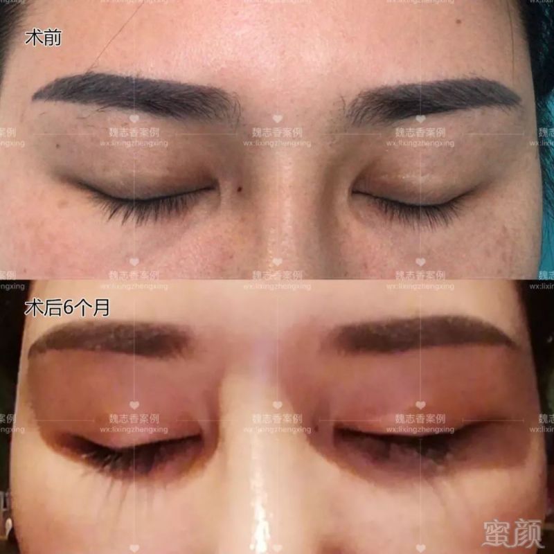 https://img.miyanlife.com/mnt/timg/180805/1330303Z2-5.jpg