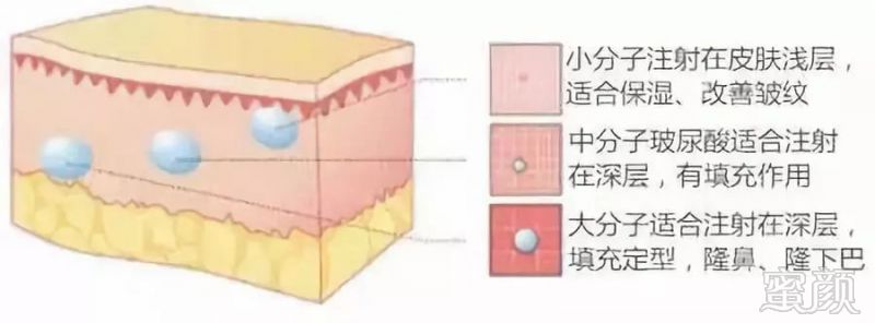 https://img.miyanlife.com/mnt/timg/180805/133Z34424-5.jpg