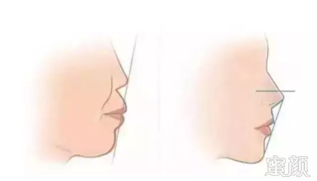 https://img.miyanlife.com/mnt/timg/180805/13401612N-6.jpg