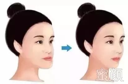 https://img.miyanlife.com/mnt/timg/180805/13401M0N-7.jpg