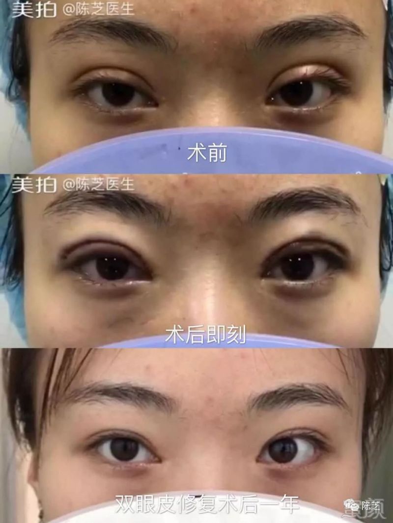 https://img.miyanlife.com/mnt/timg/180805/140J521I-2.jpg