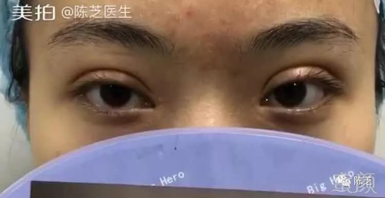 https://img.miyanlife.com/mnt/timg/180805/140J55G6-0.jpg