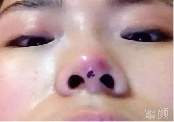 https://img.miyanlife.com/mnt/timg/180806/1112523627-5.jpg