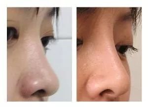https://img.miyanlife.com/mnt/timg/180806/111252G48-8.jpg