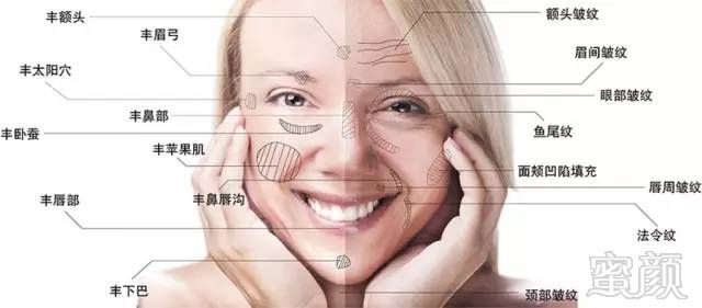 https://img.miyanlife.com/mnt/timg/180806/114G03564-5.jpg