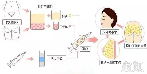 https://img.miyanlife.com/mnt/timg/180806/114G05404-6.jpg