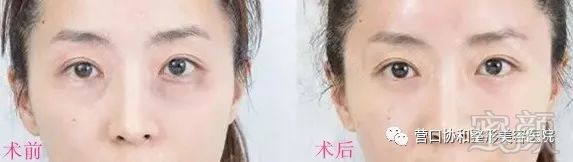 https://img.miyanlife.com/mnt/timg/180806/1159592947-7.jpg