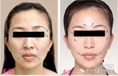 https://img.miyanlife.com/mnt/timg/180806/1159593954-4.jpg