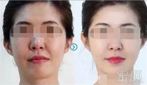 https://img.miyanlife.com/mnt/timg/180806/1202292L4-10.jpg