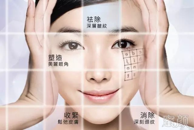 https://img.miyanlife.com/mnt/timg/180806/12022KI5-7.jpg