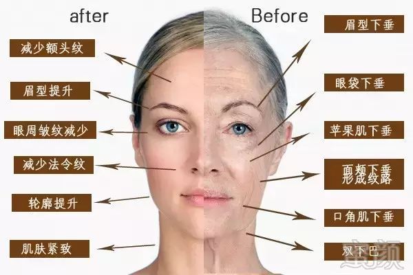 https://img.miyanlife.com/mnt/timg/180806/12022U2P-8.jpg