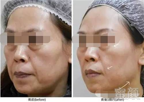 https://img.miyanlife.com/mnt/timg/180806/1202302K0-13.jpg
