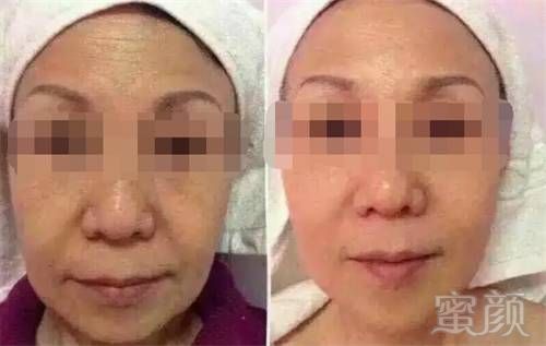 https://img.miyanlife.com/mnt/timg/180806/120230A29-11.jpg