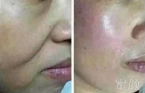 https://img.miyanlife.com/mnt/timg/180806/1202314B7-14.jpg