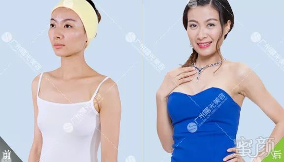https://img.miyanlife.com/mnt/timg/180806/12045063I-0.jpg