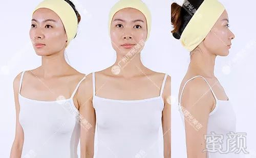 https://img.miyanlife.com/mnt/timg/180806/120452C11-7.jpg