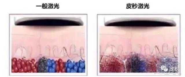 https://img.miyanlife.com/mnt/timg/180806/120FR946-5.jpg