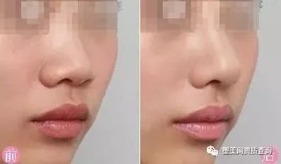 https://img.miyanlife.com/mnt/timg/180807/10530G3J-3.jpg
