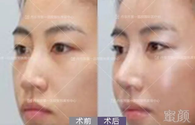 https://img.miyanlife.com/mnt/timg/180807/10530J464-4.jpg