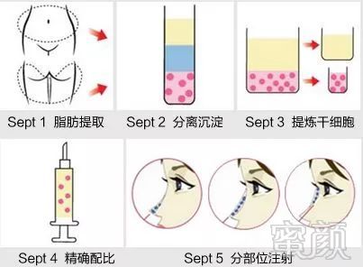 https://img.miyanlife.com/mnt/timg/180807/10531021Q-7.jpg