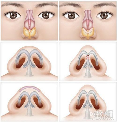 https://img.miyanlife.com/mnt/timg/180807/105H12324-4.jpg