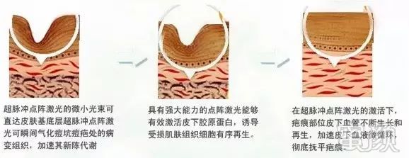 https://img.miyanlife.com/mnt/timg/180807/111FV042-6.jpg