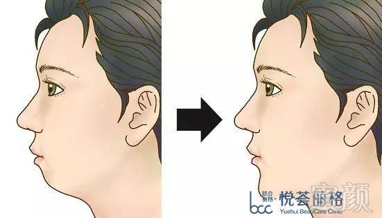 https://img.miyanlife.com/mnt/timg/180807/115015I29-8.jpg