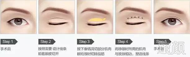 https://img.miyanlife.com/mnt/timg/180807/11540WN1-5.jpg