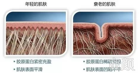 https://img.miyanlife.com/mnt/timg/180807/1202134918-1.jpg
