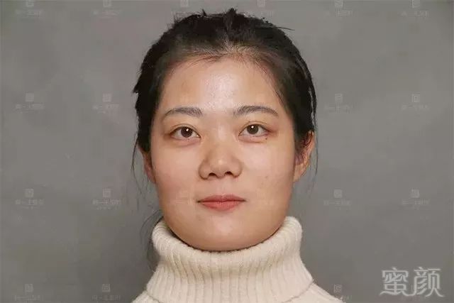 https://img.miyanlife.com/mnt/timg/180807/120HC239-4.jpg