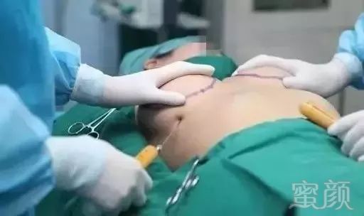 https://img.miyanlife.com/mnt/timg/180807/1210225442-4.jpg