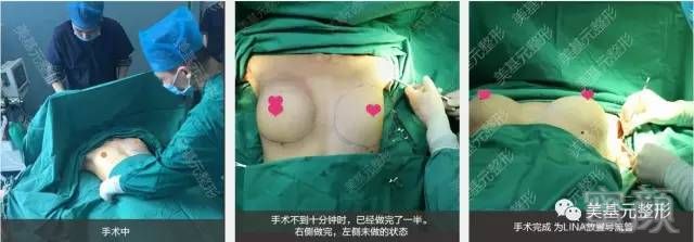 https://img.miyanlife.com/mnt/timg/180807/12120K326-12.jpg