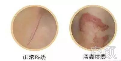 https://img.miyanlife.com/mnt/timg/180807/1212305545-1.jpg