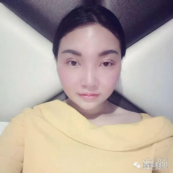 https://img.miyanlife.com/mnt/timg/180807/1213261434-3.jpg