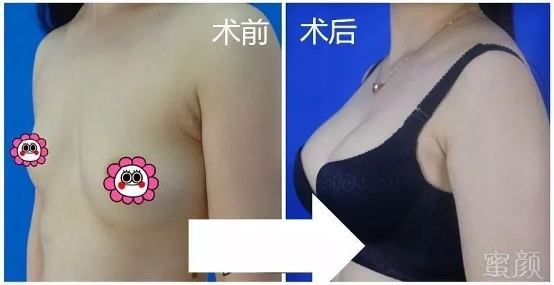 https://img.miyanlife.com/mnt/timg/180807/121G01B7-6.jpg