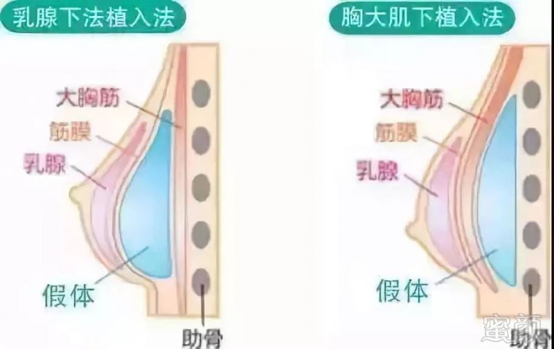 https://img.miyanlife.com/mnt/timg/180807/121G145C-9.jpg
