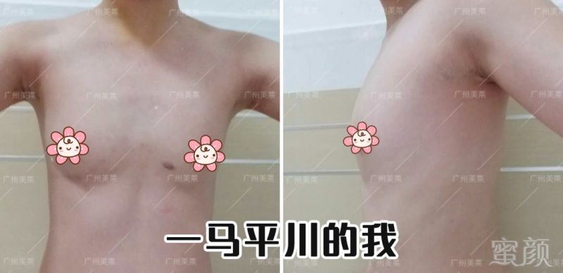 https://img.miyanlife.com/mnt/timg/180807/1224451017-1.jpg
