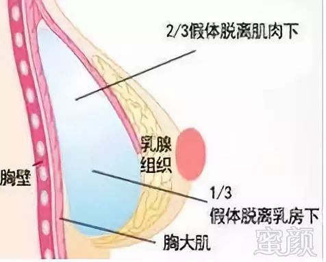 https://img.miyanlife.com/mnt/timg/180807/123KA616-6.jpg