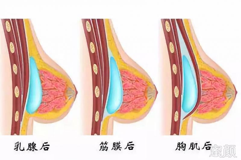 https://img.miyanlife.com/mnt/timg/180807/123KCc1-5.jpg