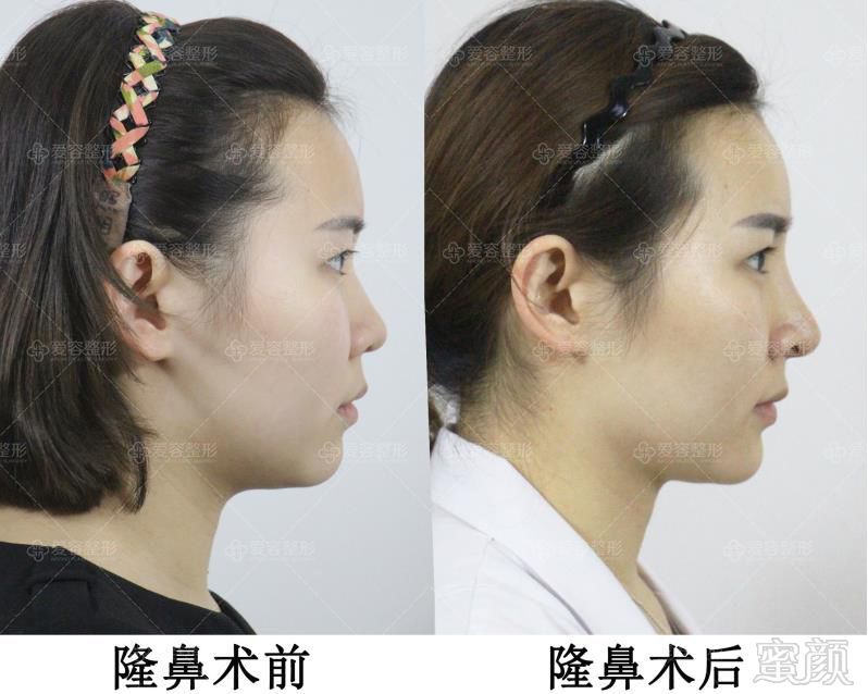 https://img.miyanlife.com/mnt/timg/180807/12400QY8-4.jpg