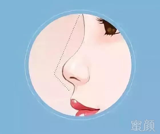https://img.miyanlife.com/mnt/timg/180807/12400RY7-3.jpg