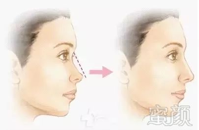 https://img.miyanlife.com/mnt/timg/180808/10455VC4-4.jpg