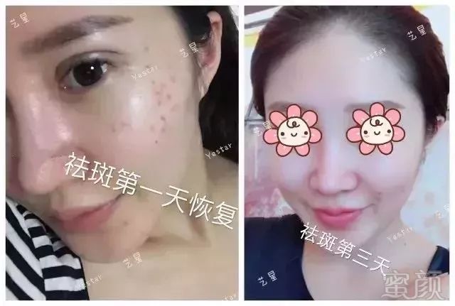 https://img.miyanlife.com/mnt/timg/180808/110QRV9-9.jpg