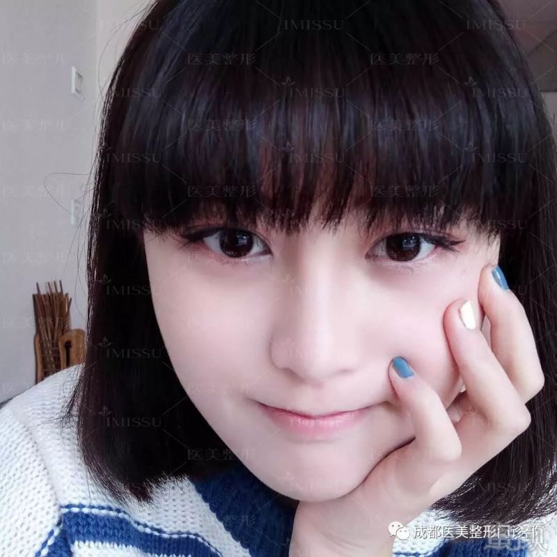 https://img.miyanlife.com/mnt/timg/180808/1110062534-8.jpg