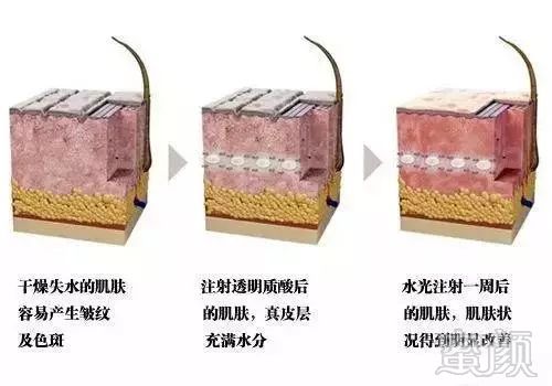 https://img.miyanlife.com/mnt/timg/180808/11342G923-0.jpg