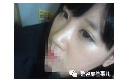https://img.miyanlife.com/mnt/timg/180808/1136094000-4.jpg